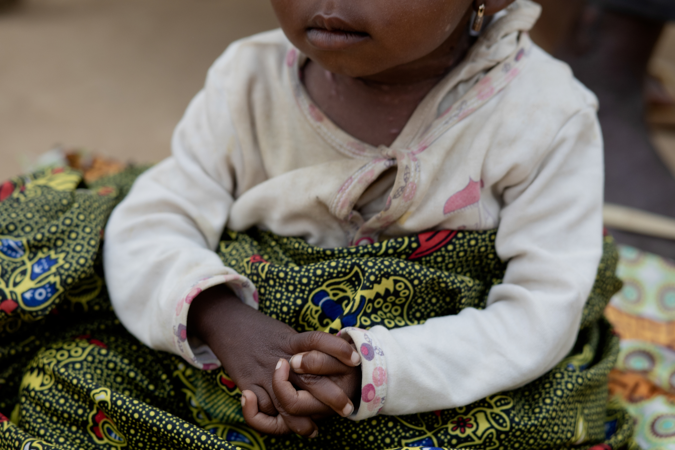 Baby Pelagie, an undernourished 10-month-old, sits with clasped hands  in Congo Rive village in the Democratic Republic of the Congo