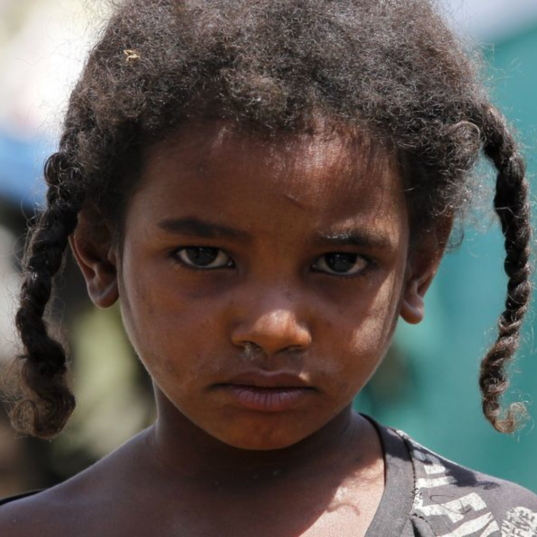 Displaced girl in Yemen